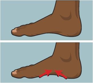 Short Foot.JPG