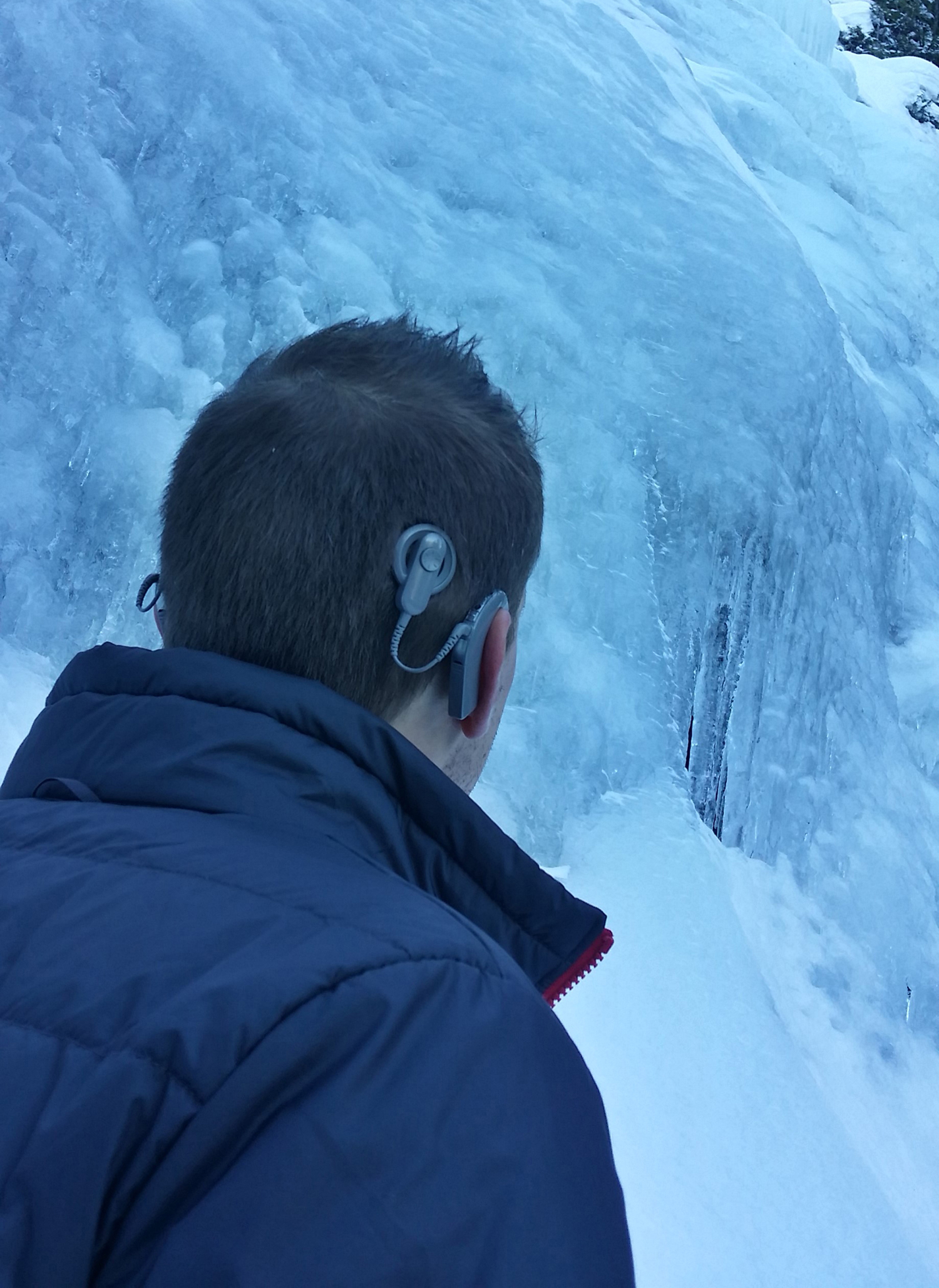 20170114_140430_richtonehdr_32425347535_o.jpg Seth Alexander’s cochlear implants